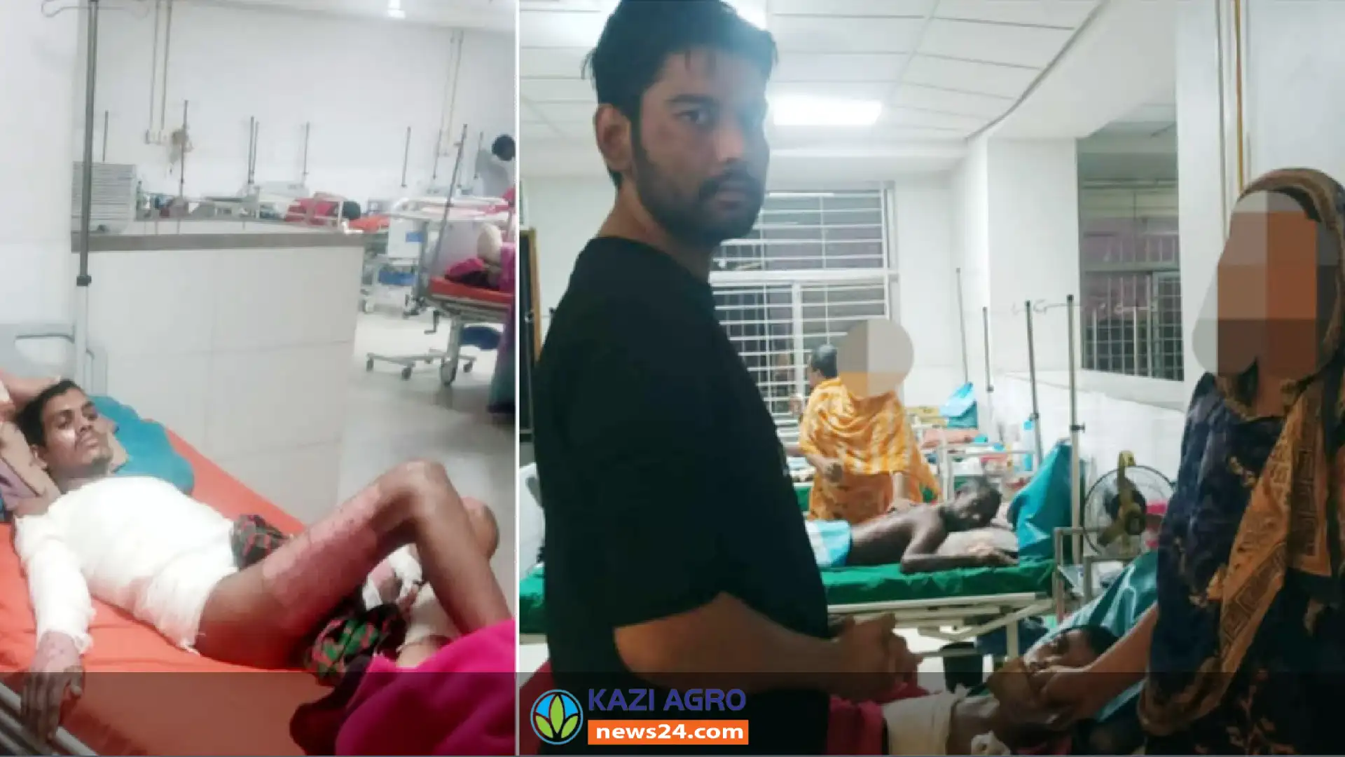 এসিডে দগ্ধ ব্যক্তিকে চিকিৎসা সহায়তা দিলেন এপি ফাউন্ডেশন