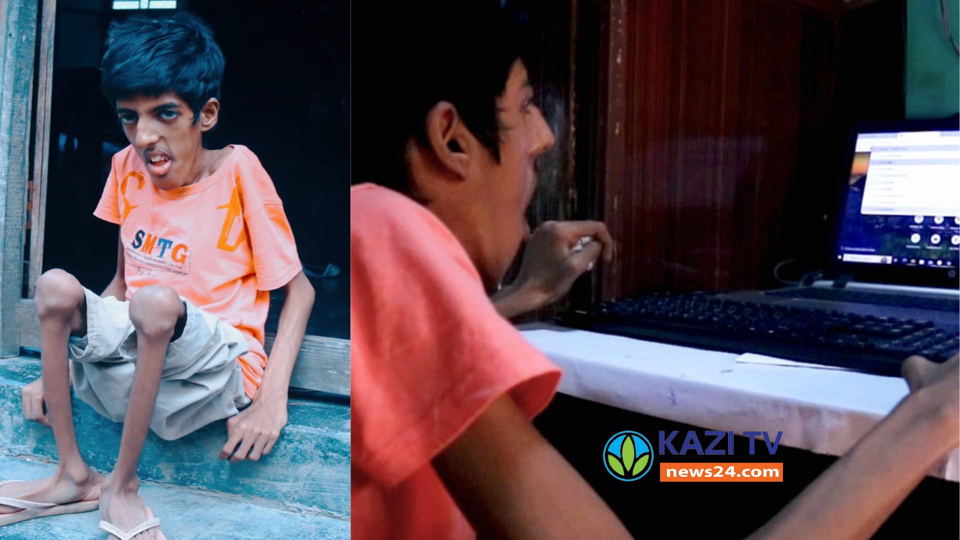 গোপালপুরে অদম্য মেধাবী ছাত্র প্রতিবন্ধী সামি