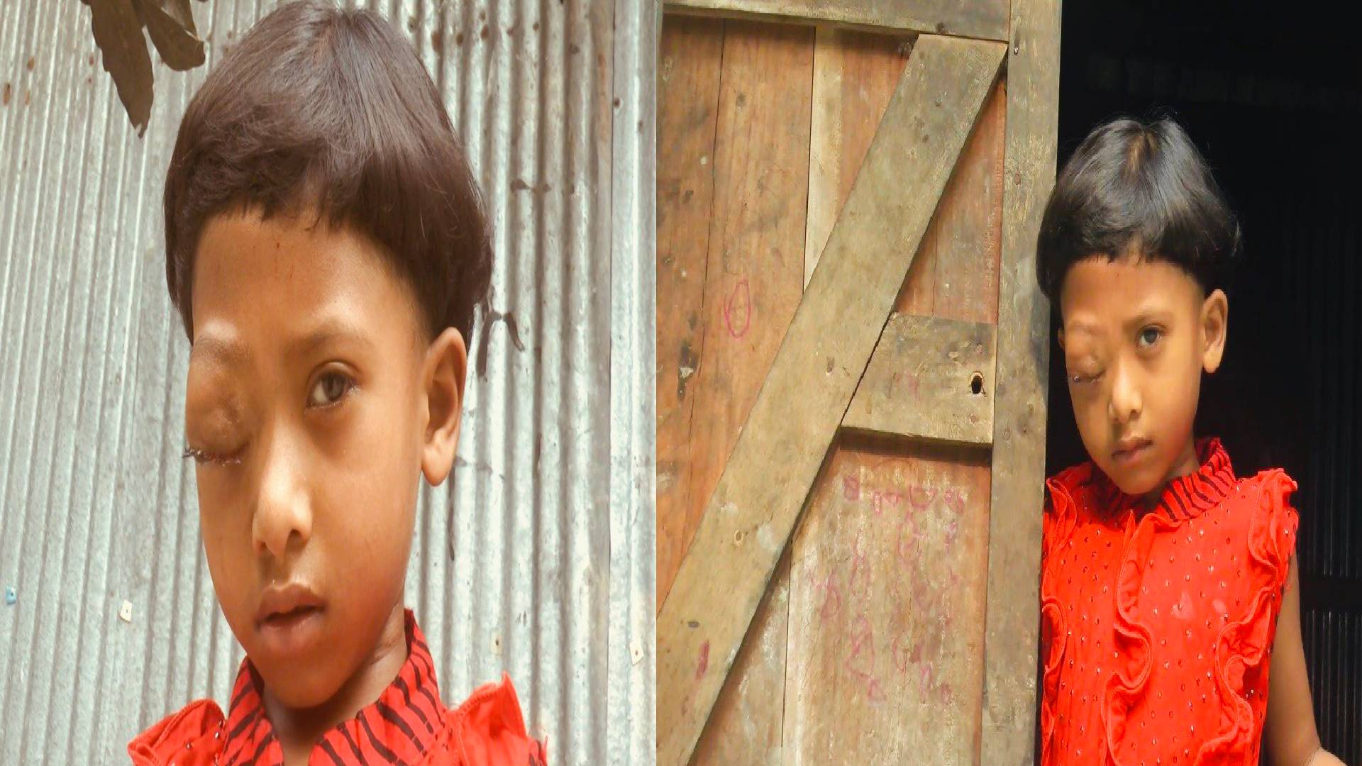 চিকিৎসার টাকার অভাবে মৃত্যুর সঙ্গে লড়ছে শিশু শায়রা