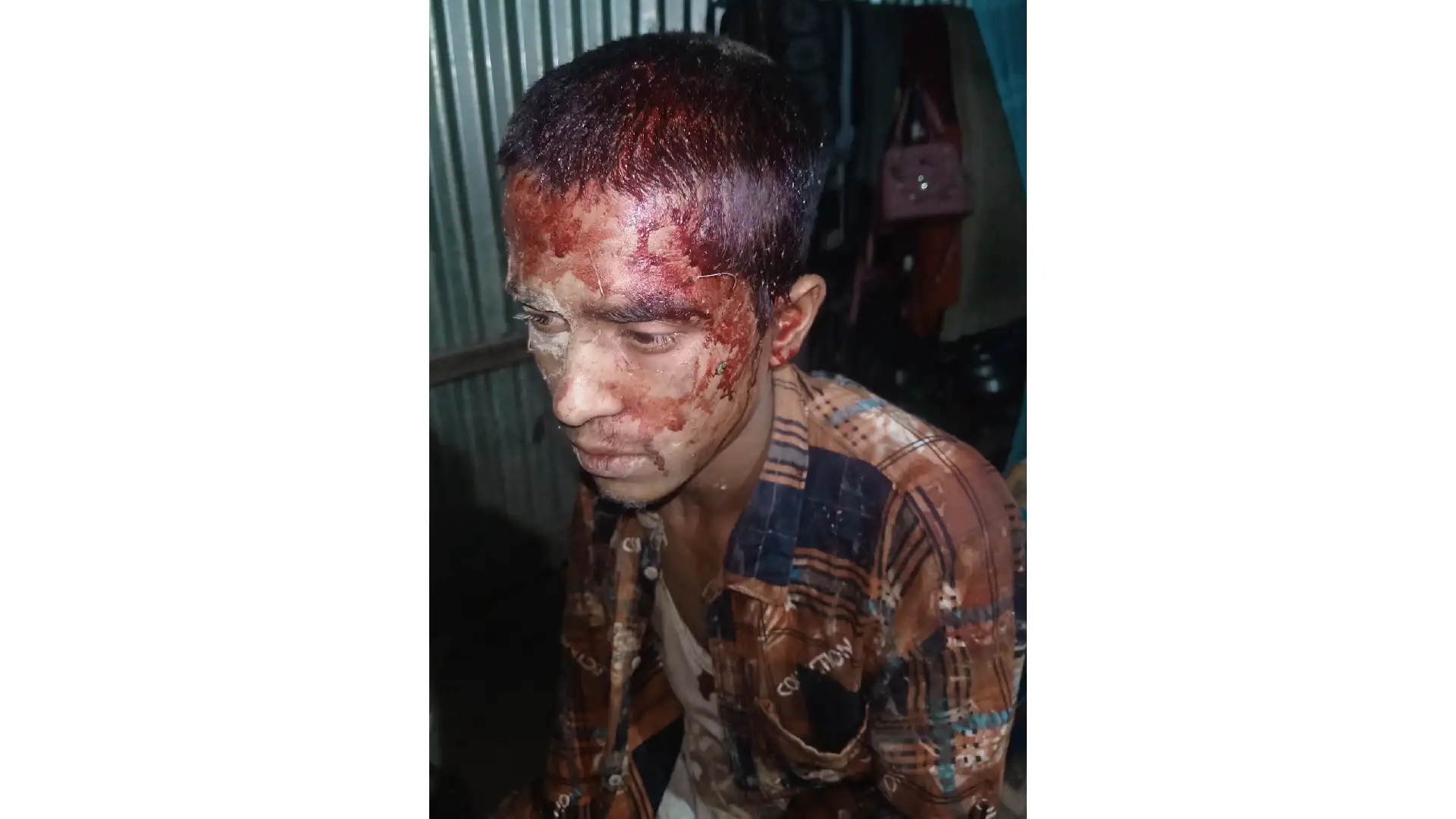 টাঙ্গাইলে পূর্ব শত্রুতার জেরে হত্যা চেষ্টার ঘটনায় গুরুতর আহত-১