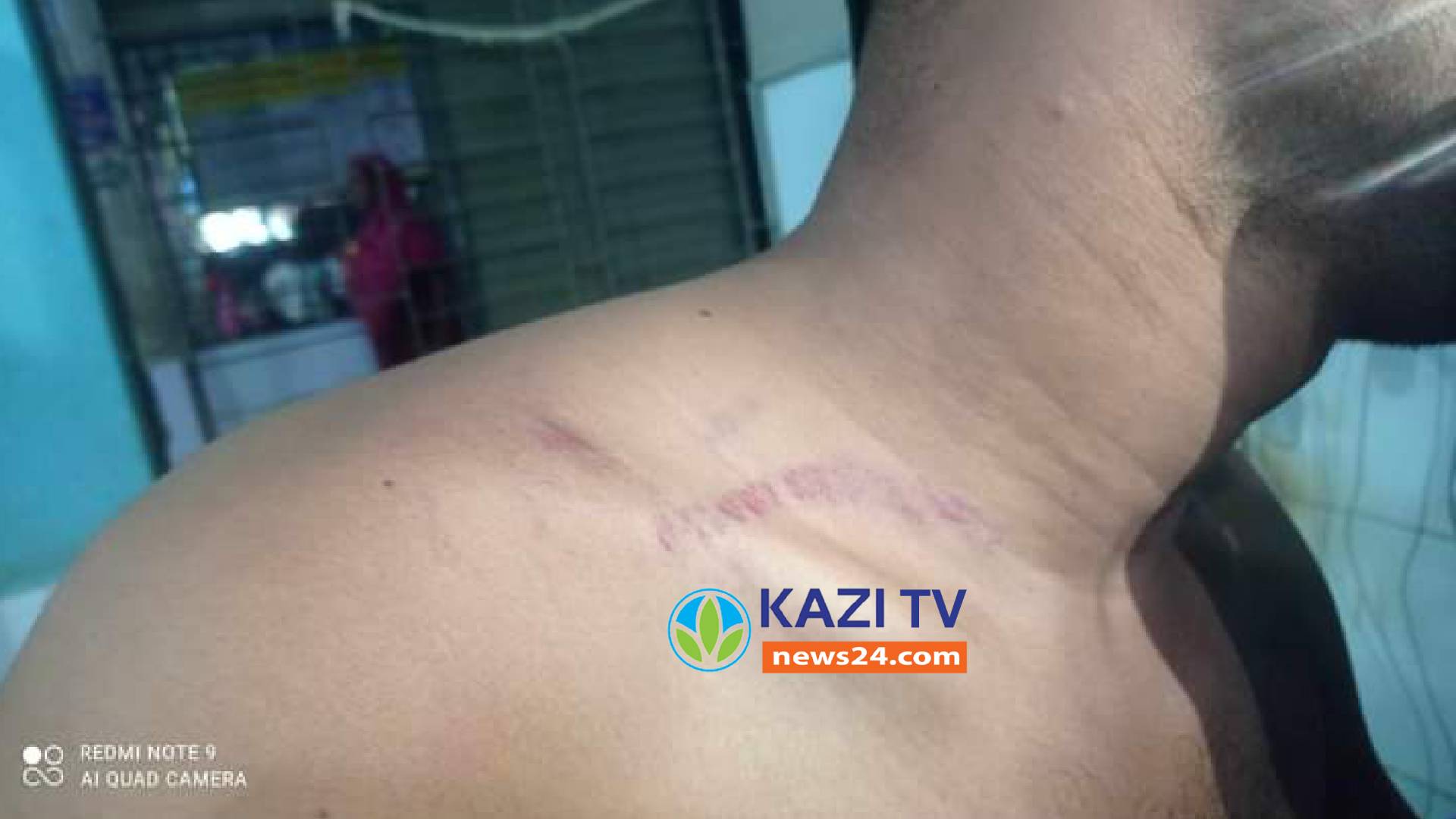 তাড়ি ব্যবসায়ি থেকে ডাক্তার বিমল প্রামাণিক