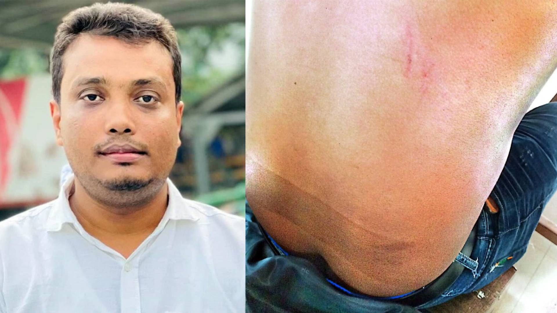 মতলব উত্তরে কালবেলার সাংবাদিকের উপর সন্ত্রাসী হামলা