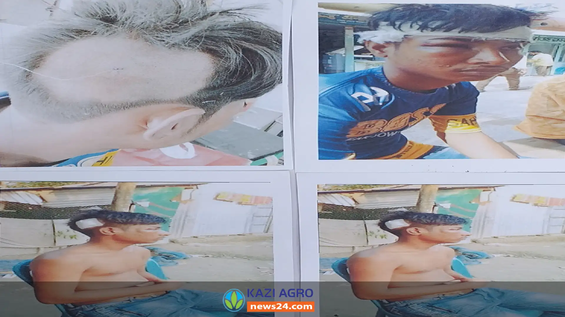 মতলব উত্তরে তুচ্ছ ঘটনাকে কেন্দ্র করে এক কিশোরকে জঘন্যতম মারপিট