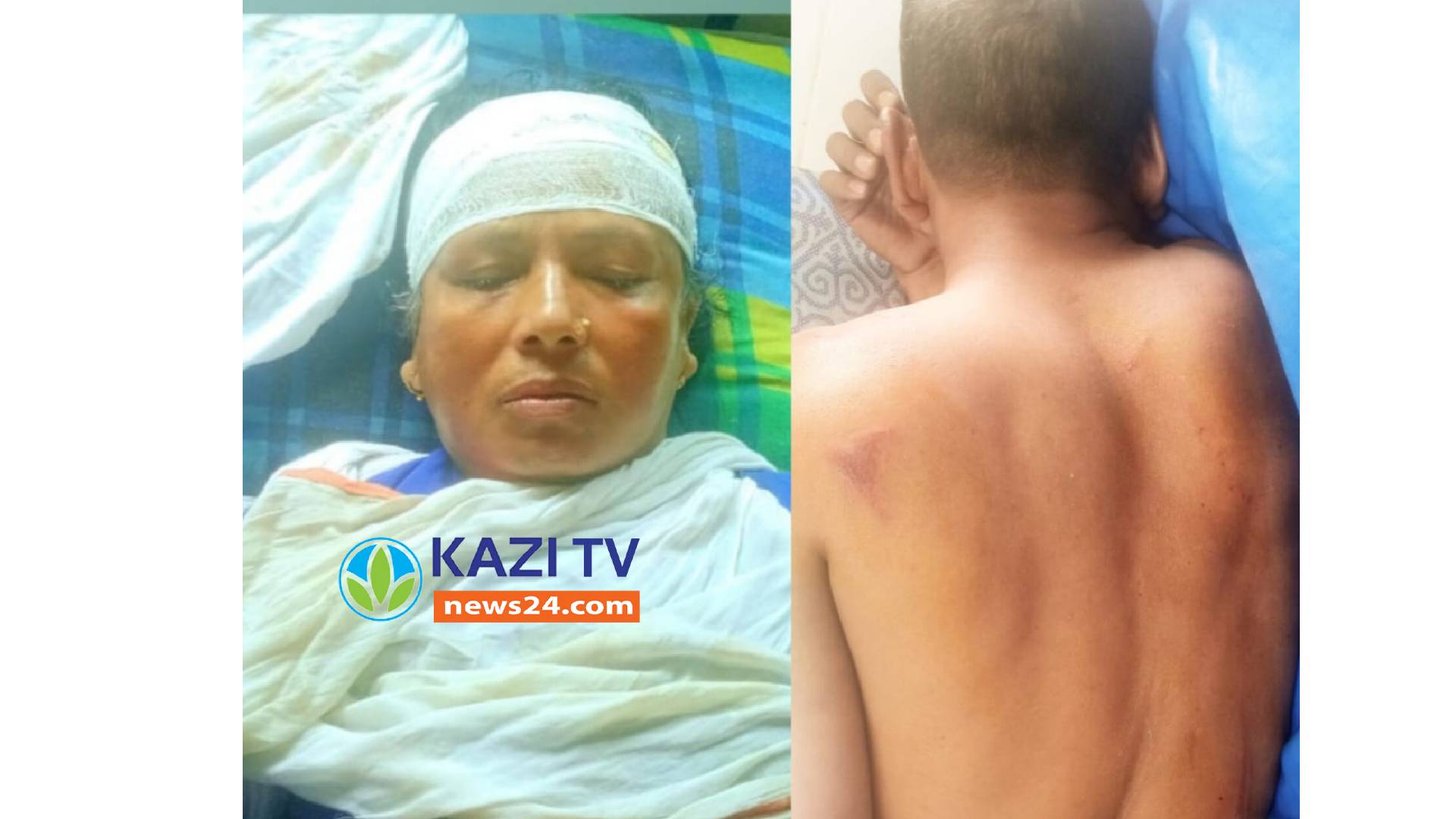 মতলব উত্তরে পূর্ব শত্রুতার জের ধরে হামলা আহত ২