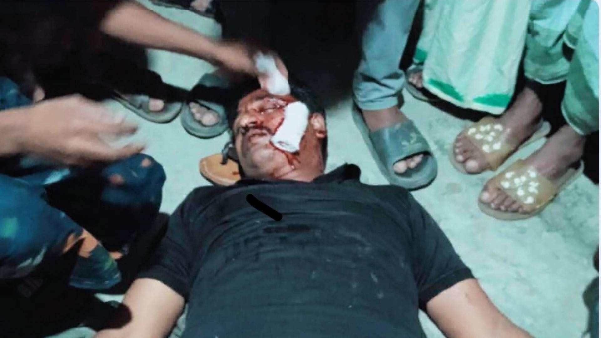 রাজশাহী দুর্গাপুরে চাইনিজ কুড়ালের কুপে এক  যুবক আহত