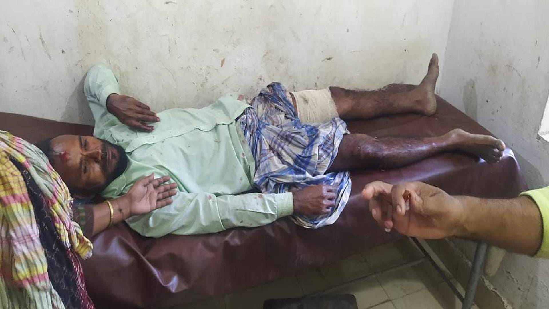 সোনারগাঁয়ে দু’পক্ষের সংঘর্ষ, টেঁটাবিদ্ধসহ আহত ১২